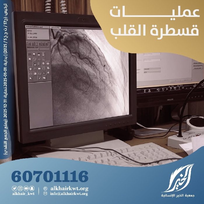 صورة عمليات قسطرة القلب 